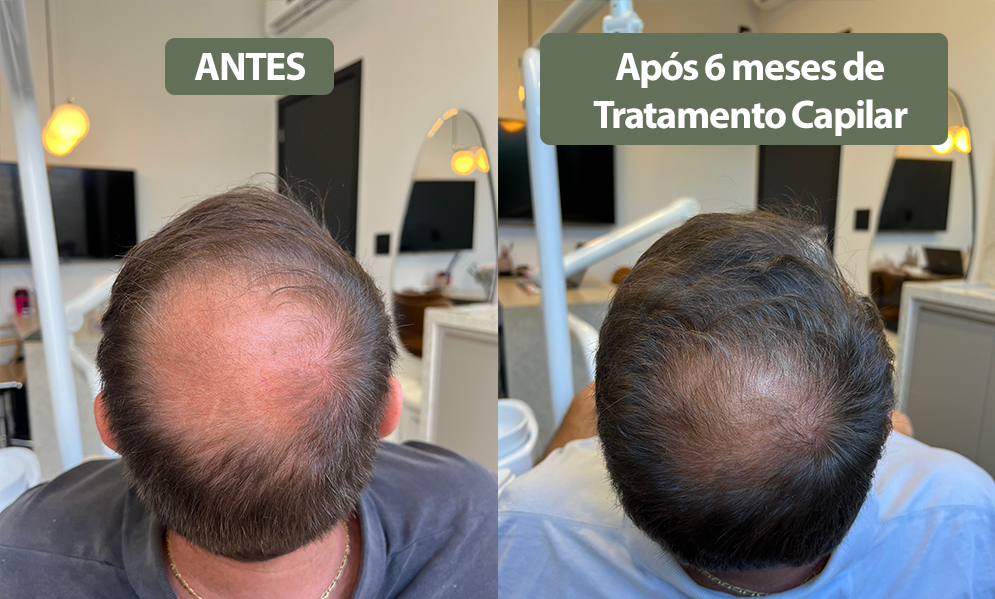 antes e depois 7